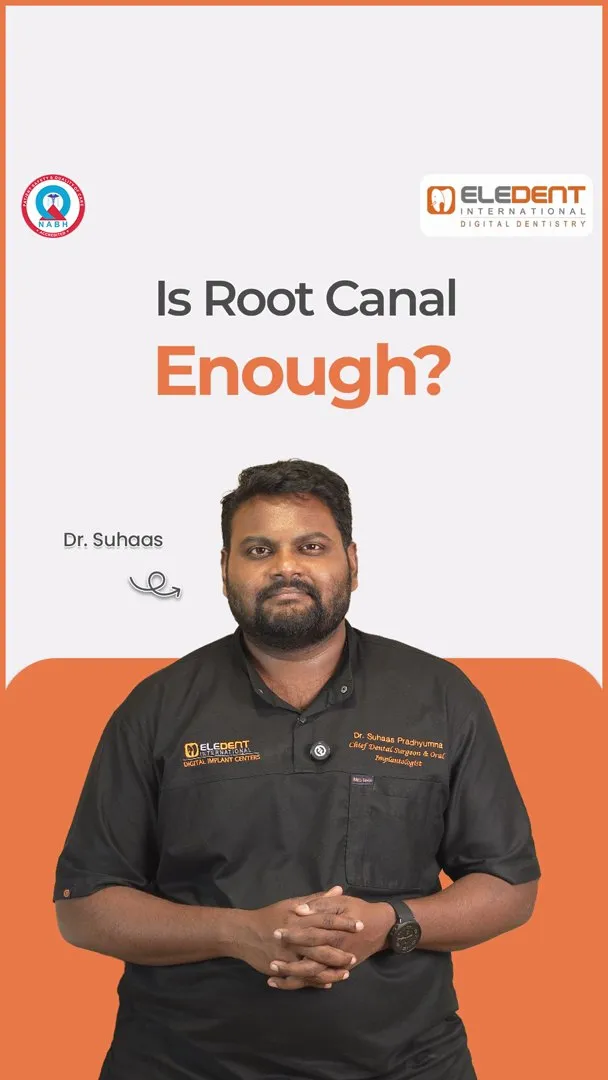 Post by Eledent Dental Hospitals | Dental Surgery