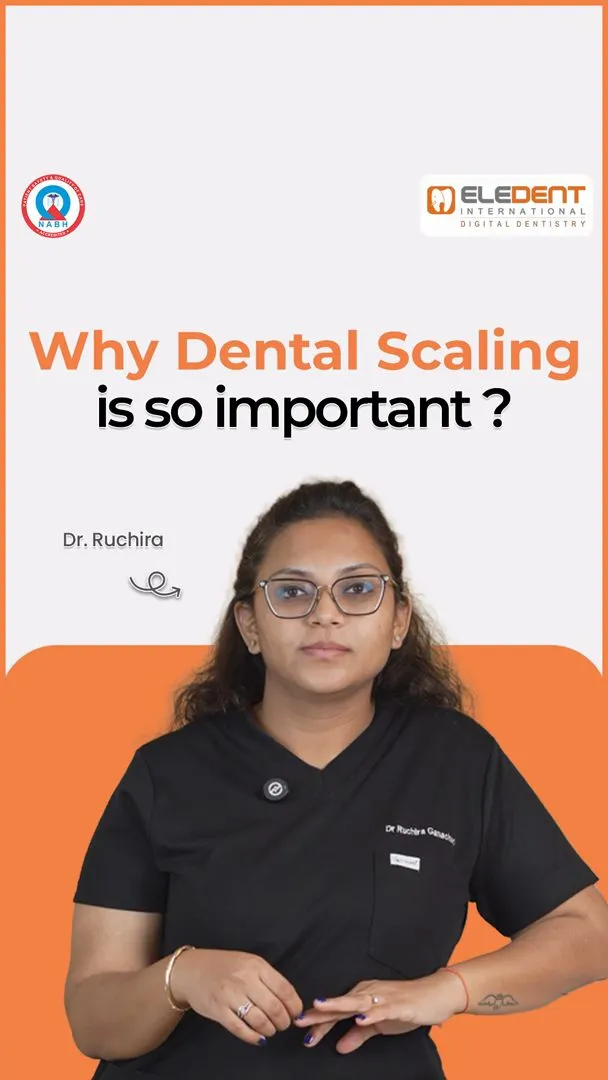 Post by Eledent Dental Hospitals | Dental Surgery